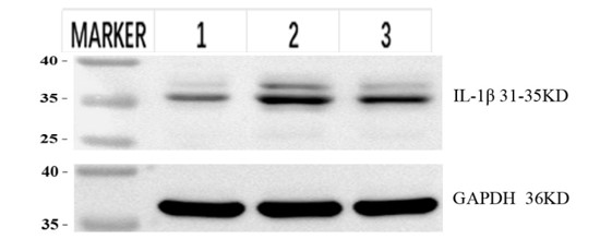 a00101 il1b primary antibodies wb review 2