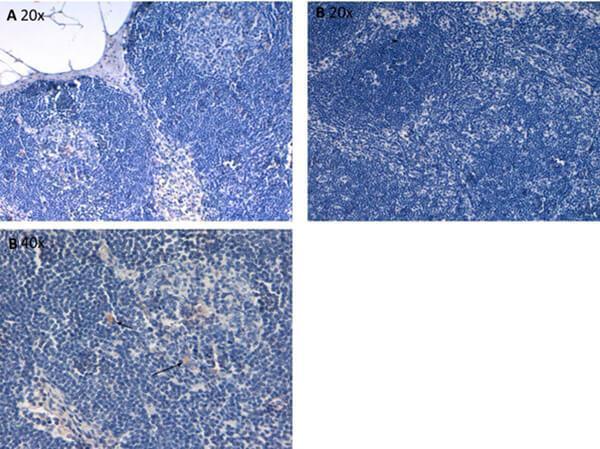 Immunohistochemistry of Rabbit Anti-IL6-Antibody