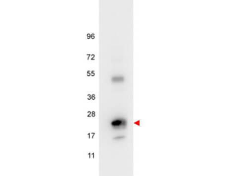 Western blot using Boster