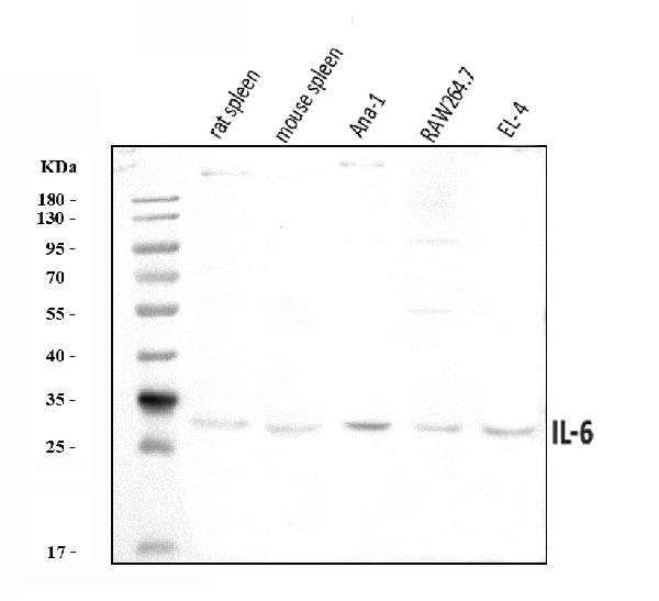 Western blot analysis of IL6 using anti-IL6 antibody (A00102-2).