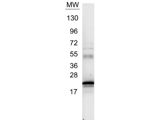 Western blot using Boster's Anti-IL6 antibody