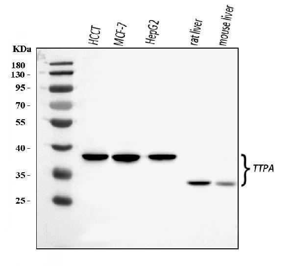  Western blot analysis of TTPA/TPP1 using anti-TTPA/TPP1 antibody (A00103-1)