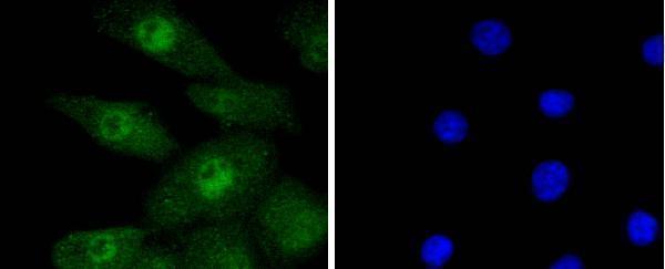 ICC staining Phospho-Erk1(T202)+Erk2(T185) in A549 cells (green)