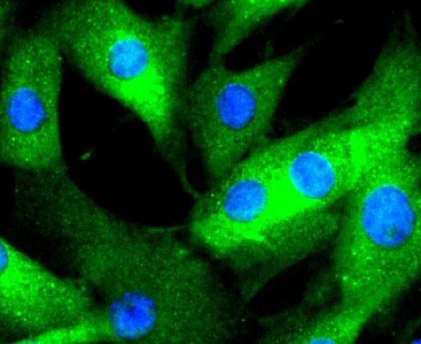 ICC staining Phospho-Erk1(T202)+Erk2(T185) in NIH/3T3 cells (green)