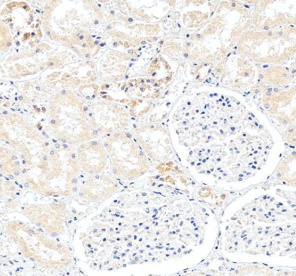 a00106 1 hla dqb1 primary antibodies ihc testing 1
