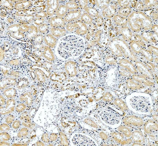 a00106 1 hla dqb1 primary antibodies ihc testing 2