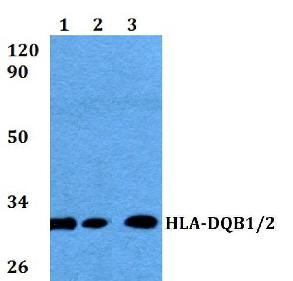 a00106 2 hla dqb1 primary antiboties wb testing 1