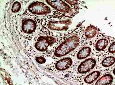 Immunohistochemistry (IHC) analysis of paraffin-embedded Human Colon, antibody was diluted at 1:100