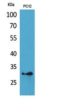 Western Blot (WB) analysis of PC12 cells using HLA-DQB1/2 Polyclonal antibody