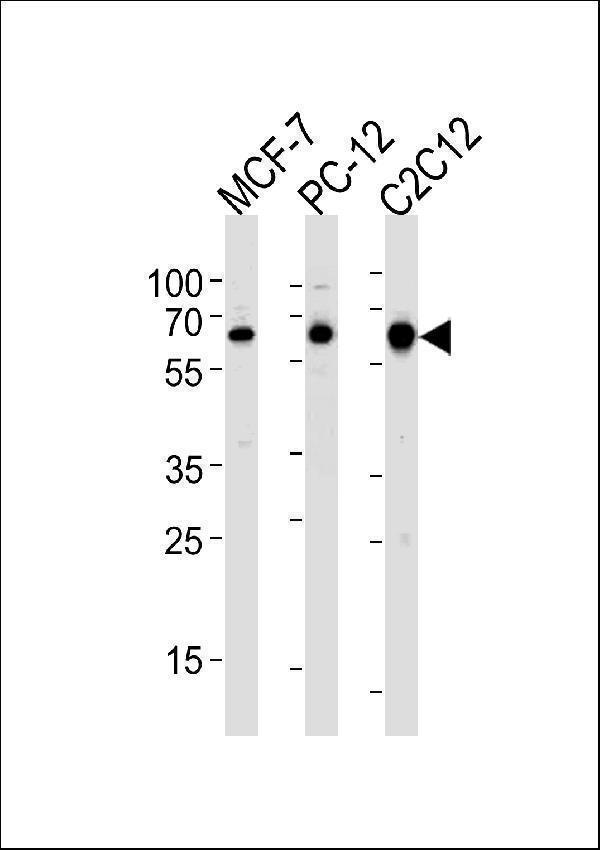 Western blot analysis of lysates from MCF-7,rat PC-12,mouse C2C12 cell line (from left to right),using SRC Antibody (R14) (Cat