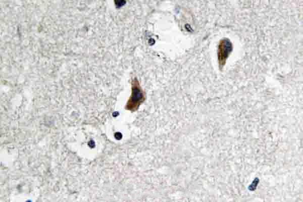 a00107s69 src primary antiboties ihc testing 2