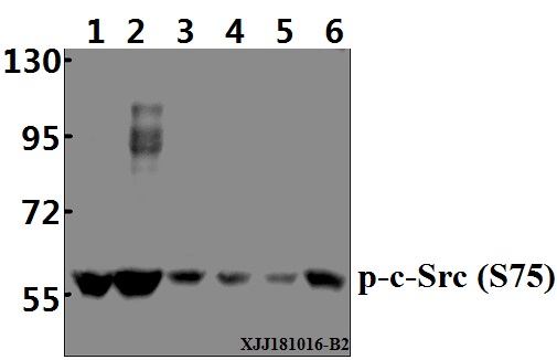 a00107s75 src primary antiboties wb testing 1