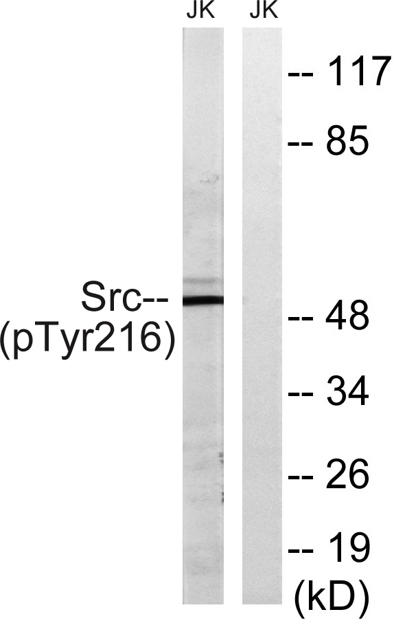 Western blot analysis of lysates from Jurkat cells treated with EGF 200ng/ml 5', using Src (Phospho-Tyr216) Antibody