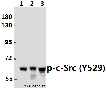 Western blot (WB) analysis of p-c-Src (Y529) pAb at 1:500 dilution
Lane1:A375 whole cell lysate(20ug)
Lane2:The Uterus tissue lysate of Mouse(20ug)
Lane3:The Uterus tissue lysate of Rat(20ug)