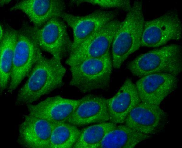 ICC staining Glucose 6 phosphate isomerase in MCF-7 cells (green)