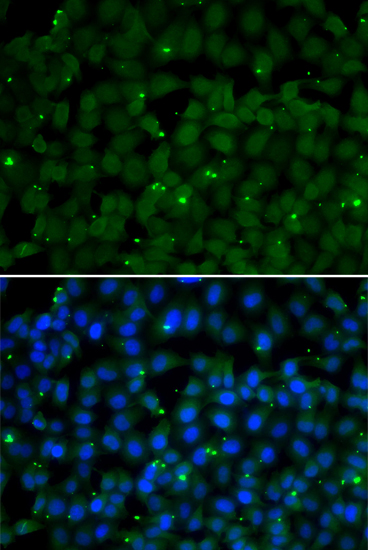 Immunofluorescence analysis of U20S cell using GPI antibody