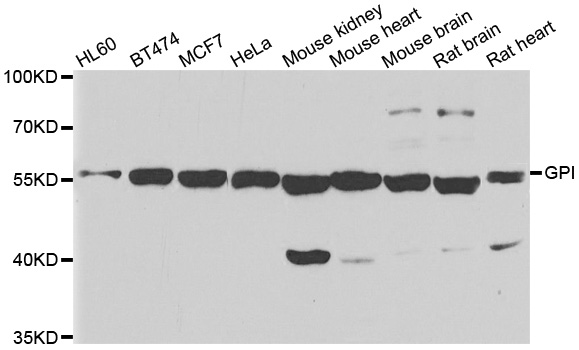 Western blot analysis of extracts of various cell lines, using GPI antibody