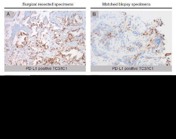 a00109 1 cd274 primary antibodies ihc testing 14