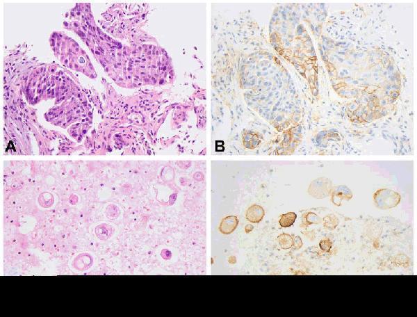 a00109 1 cd274 primary antibodies ihc testing 15