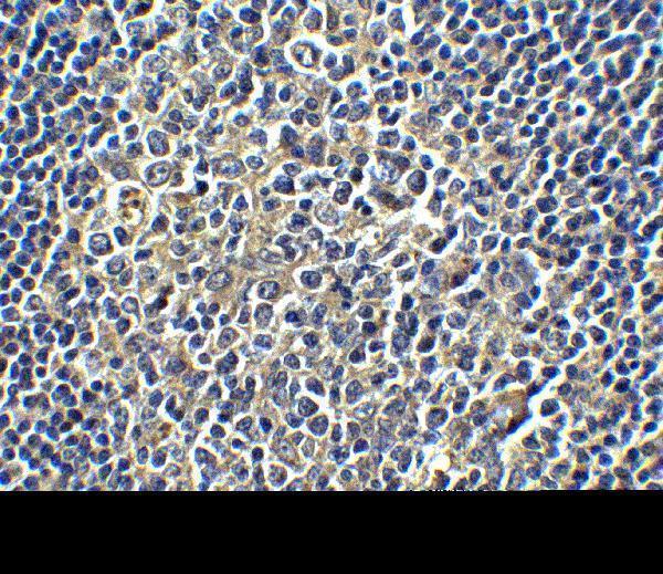 a00109 1 cd274 primary antibodies ihc testing 5