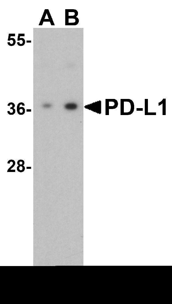 Western Blot Validation of PD-L1 in HeLa Cells
Loading: 15 μg of lysates per lane