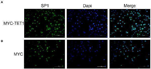 Immunofluorescence staining of SP1 in overexpressed and control cells cultured in vitro 