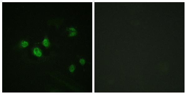 Immunofluorescence analysis of HeLa cells, using SP1 (Phospho-Thr453) Antibody