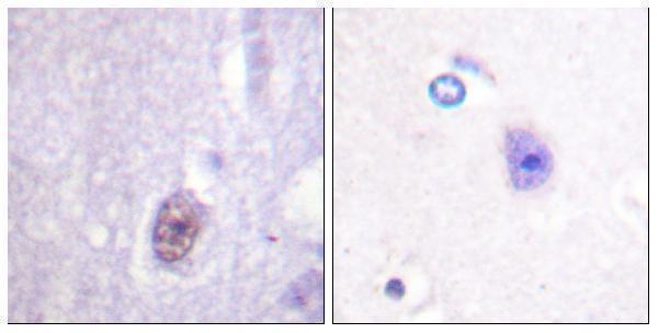 Immunohistochemistry analysis of paraffin-embedded human brain, using SP1 (Phospho-Thr453) Antibody