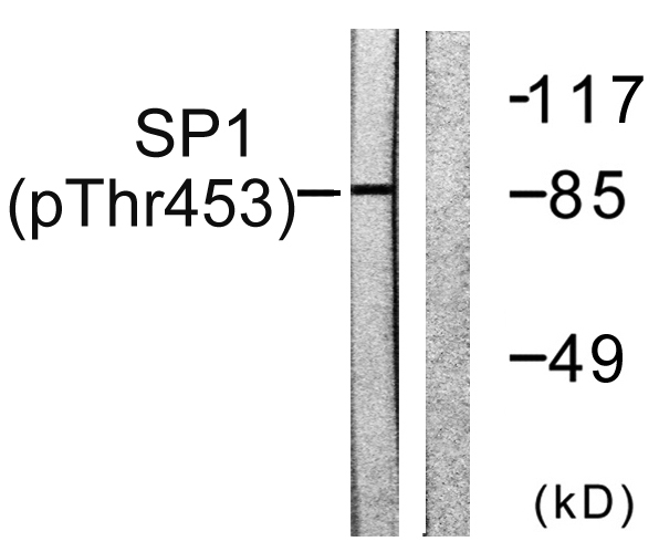 Western blot analysis of lysates from A549 cells, using SP1 (Phospho-Thr453) Antibody
