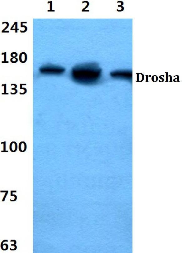 Western blot (WB) analysis of Drosha polyclonal antibody at 1:500 dilution
Lane1:Hela cell lysate
Lane2:sp2/0 cell lysate
Lane3:PC12 cell lysate