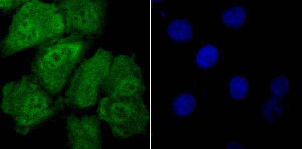 ICC staining Drosha in A549 cells (green)