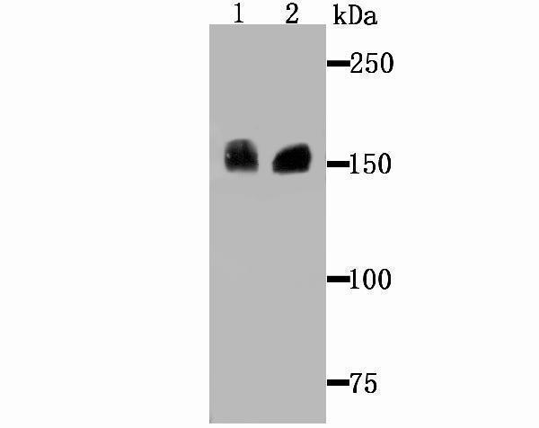 Western blot analysis of Drosha on Hela cell and SiHa cell lysates using anti-Drosha antibody at 1/500 dilution