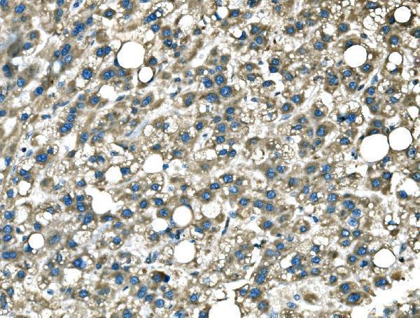  IHC analysis of DROSHA using anti-DROSHA antibody (A00111-4)