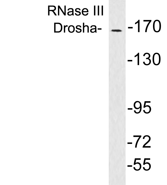 Western blot analysis of lysates from brain tissue, using RNase III Drosha antibody