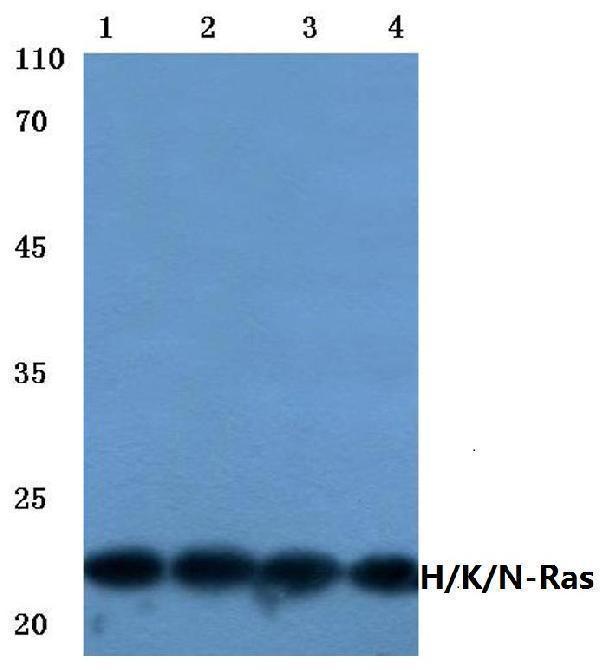 Western blot (WB) analysis of Ras (H27) polyclonal antibody at 1:500 dilution
Lane1:HEK293T cell lysate
Lane2:Hela cell lysate
Lane3:Mouse brain tissue lysate
Lane4:Rat heart tissue lysate