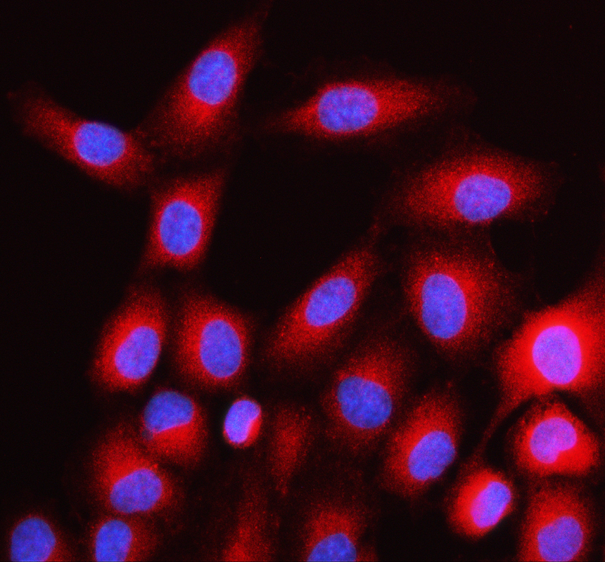 a00114 gtpase hras primary antibodies if testing 1