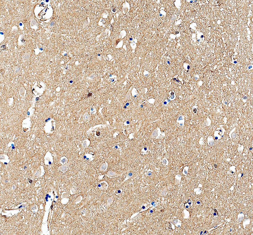 IHC analysis of GTPase HRAS using anti-GTPase HRAS antibody (A00114)