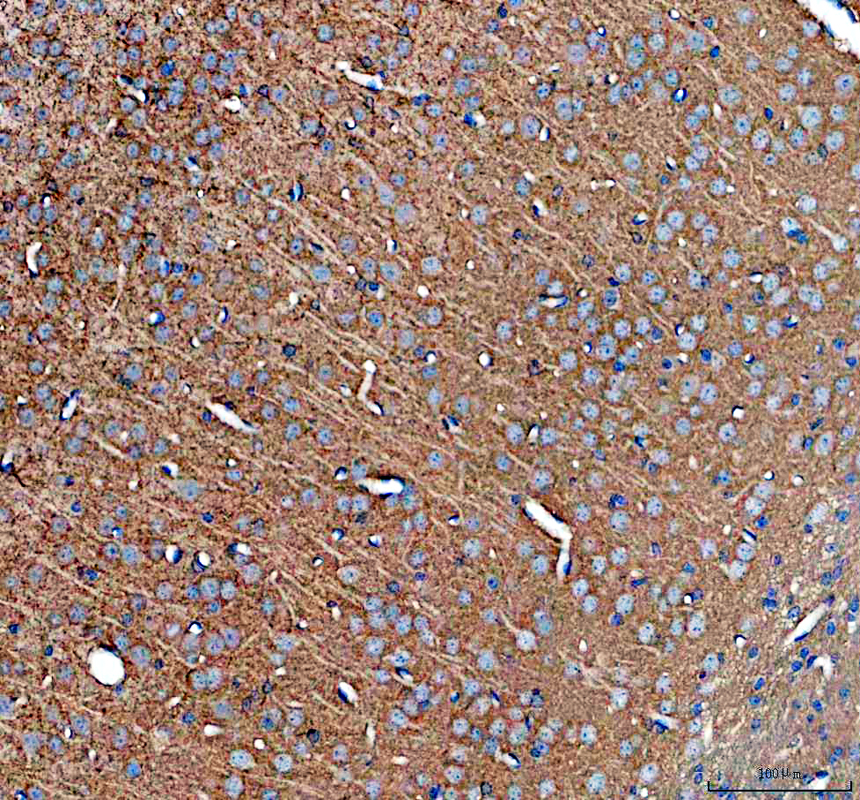 IHC analysis of GTPase HRAS using anti-GTPase HRAS antibody (A00114)
