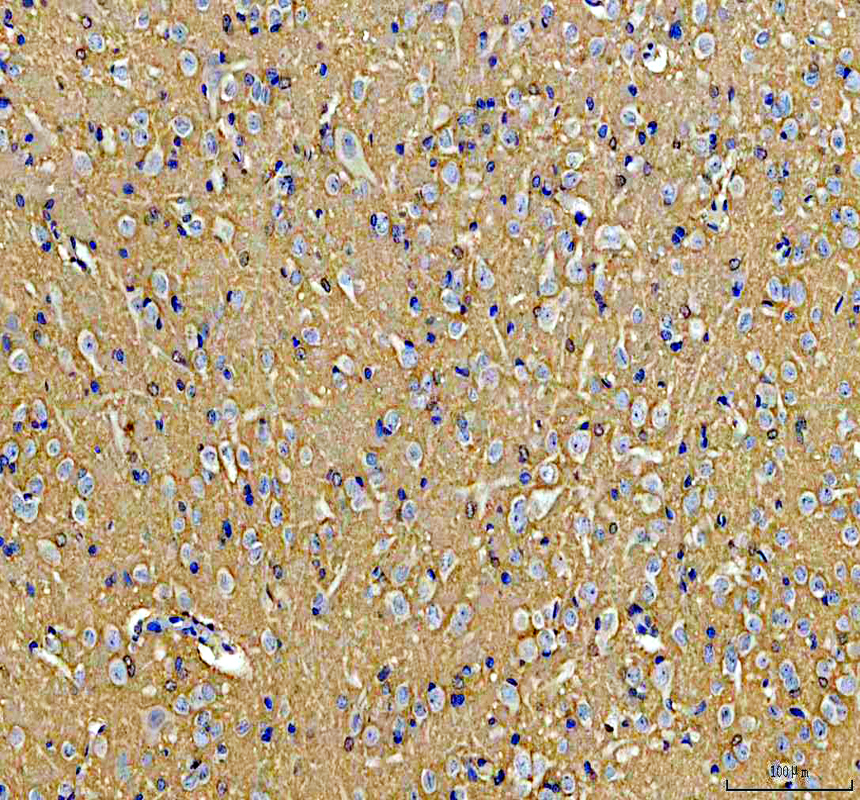 a00114 gtpase hras primary antibodies ihc testing 3