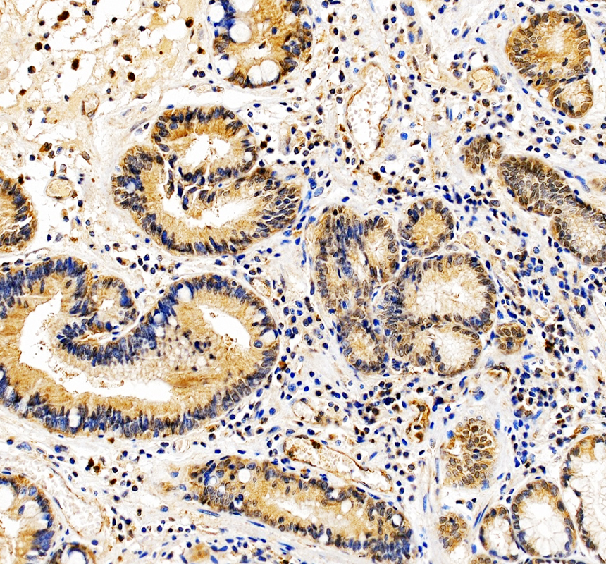 a00114 gtpase hras primary antibodies ihc testing 4