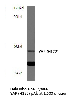Western blot (WB) analysis of YAP (H122) polyclonal antibody in extracts from HepG2 cells