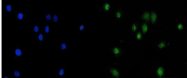 a00117 ep300 primary antibodies if testing 6