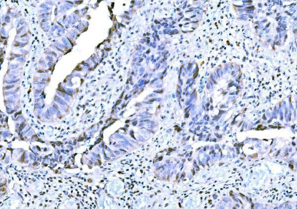  IHC analysis of KAT3B/P300/EP300 using anti-KAT3B/P300/EP300 antibody (A00117)