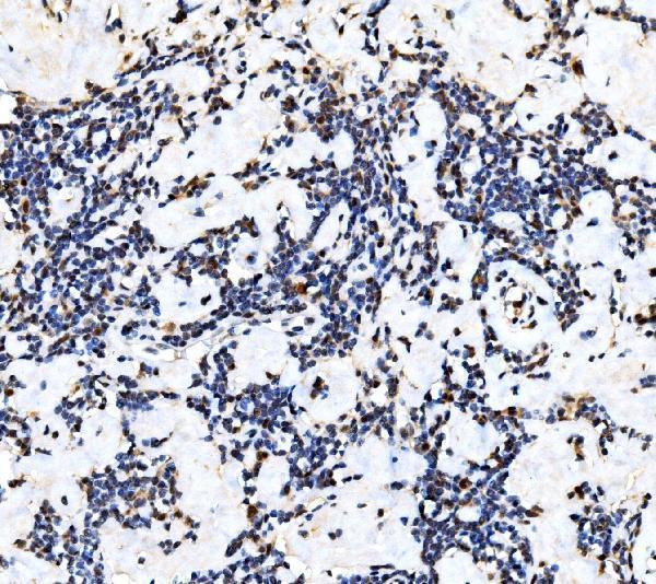  IHC analysis of KAT3B/P300/EP300 using anti-KAT3B/P300/EP300 antibody (A00117)