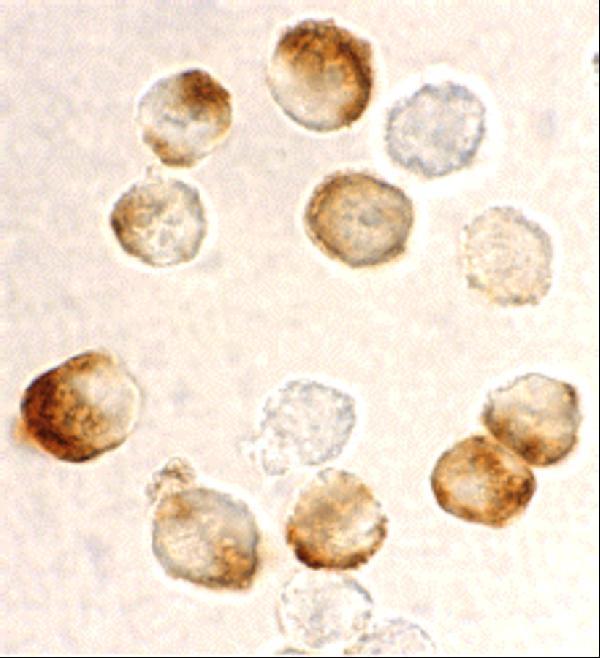Immunocytochemistry staining of HeLa cells using IKK beta antibody at 10 μg/mL