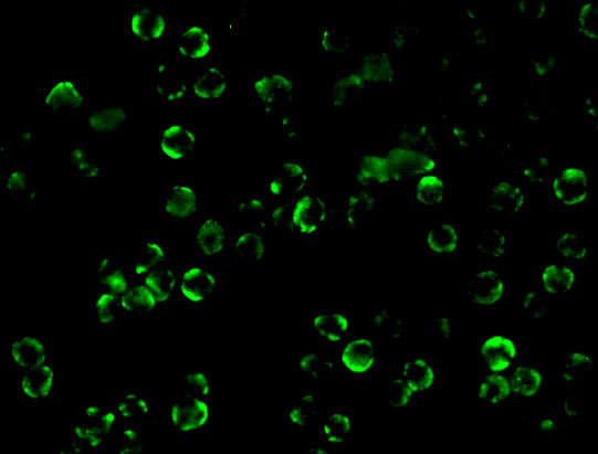 Immunofluorescence of IKK beta in Hela cells with IKK beta antibody at 10 μg/mL