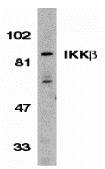 Western blot analysis of IKK beta in Jurkat whole cell lysate with IKK beta antibody (C3) at 1:500 dilution