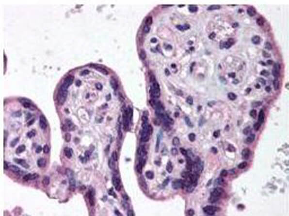 a00118 ikbkb primary antibodies ihc testing 1
