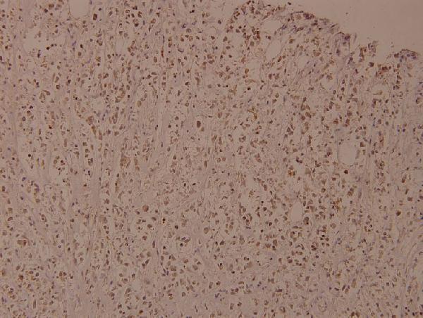 a00118y188 ikbkb primary antiboties ihc testing 2