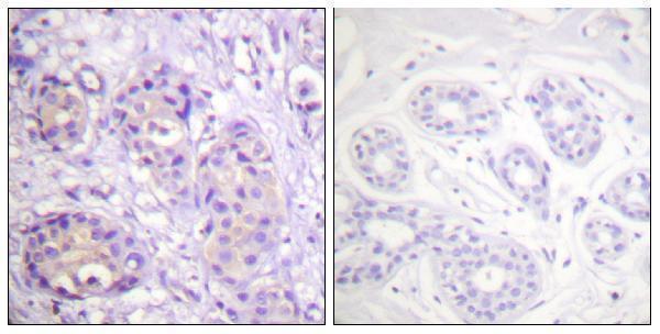 a00118y199 1 ikbkb primary antibodies ihc testing 3